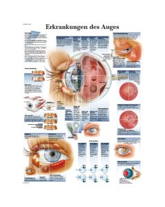 Lehrtafel über Erkrankungen des Auges mit ganz vielen bildlichen und textlichen Informationen