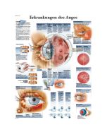 Lehrtafel über Erkrankungen des Auges mit ganz vielen bildlichen und textlichen Informationen